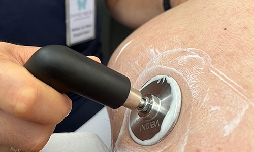 TECAR Therapy (INDIBA)